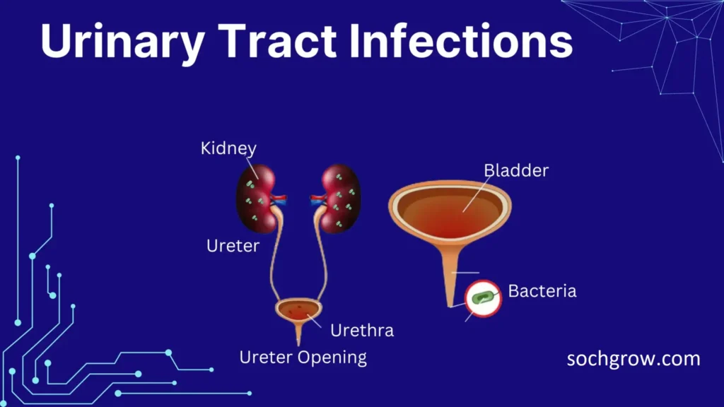 Urinary Tract Infections